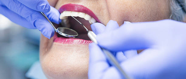Best Emergency Gum Treatment in Panacea, FL